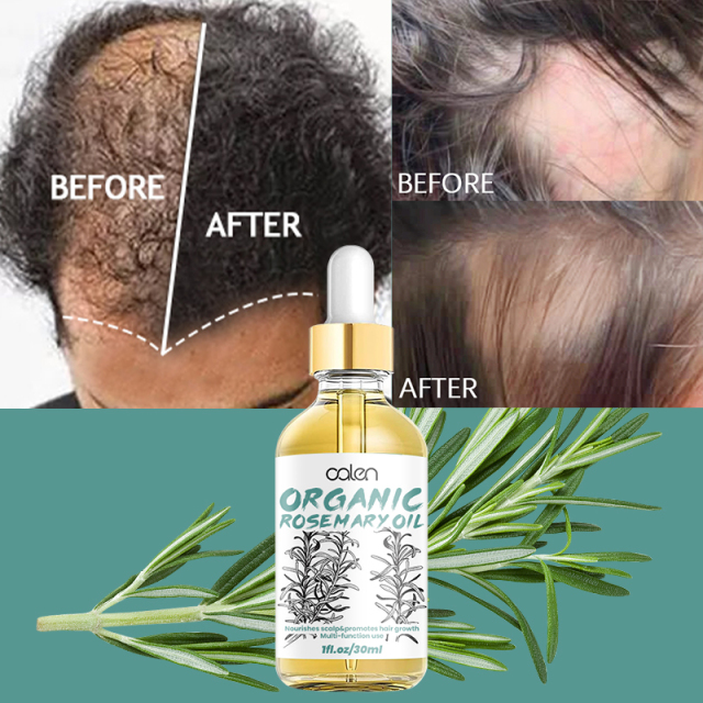 Oalen 30ML ODM OEM Improves Hair Texture Rosemary Oil Hair,oalen cosmetics