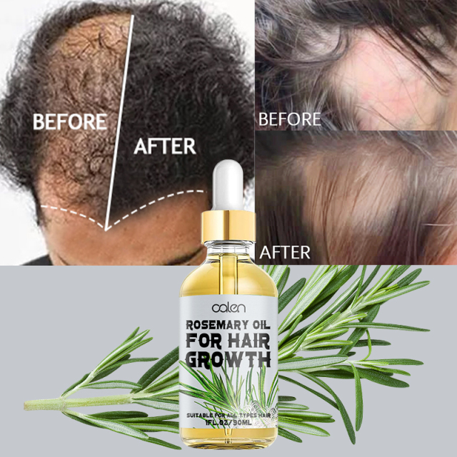 Oalen 30ML Wholesale Hair Growth Oganic Rosemary Oil,oalen cosmetics