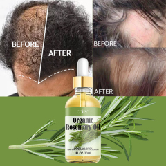 Luxfume Private Label Relieve Scalp Hair Regrowth Rosemary Hair Oil,oalen cosmetics
