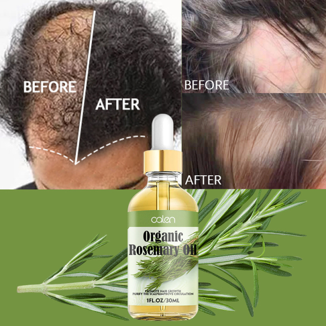 Luxfume Private Label Relieve Scalp Hair Regrowth Rosemary Hair Oil,oalen cosmetics