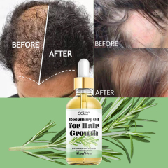 Oalen OEM Enhances Hair Dry Scalp Hair Growth Rosemary Oil,oalen cosmetics