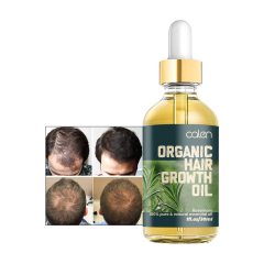 Luxfume 30ML Wholesale Private Label Promotes Hair Growth Antioxidant Oganic Rosemary Oil,oalen cosmetics