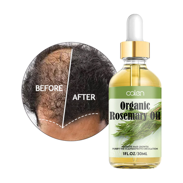 Luxfume Private Label Relieve Scalp Hair Regrowth Rosemary Hair Oil,oalen cosmetics