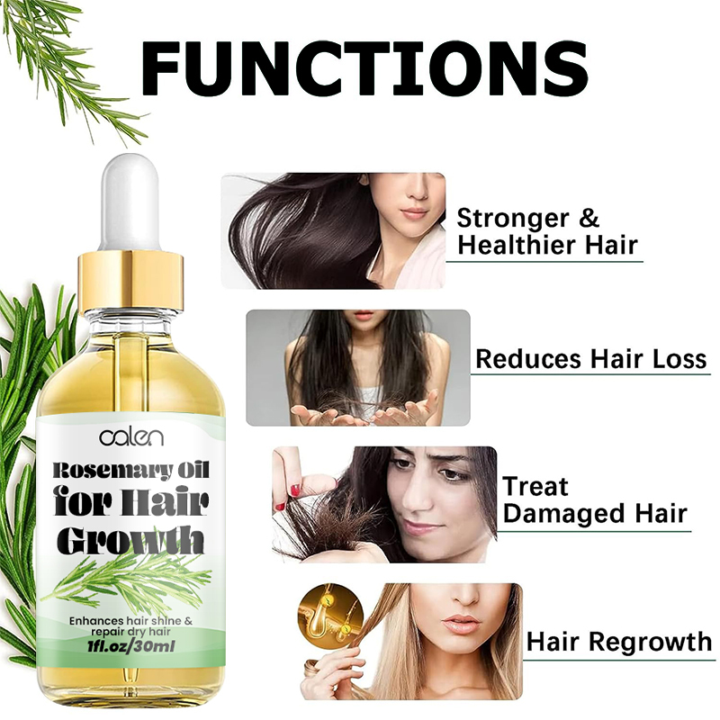 Oalen OEM Enhances Hair Dry Scalp Hair Growth Rosemary Oil,oalen cosmetics