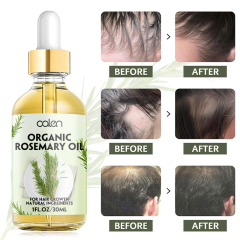 30ML Factory ODM OEM Improves Hair Texture Intensive Deep Treatment Rosemary Oil Hair,oalen cosmetics