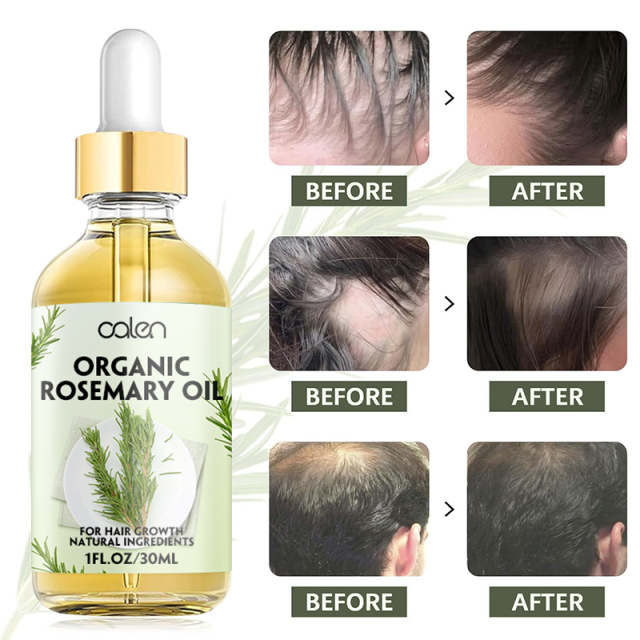 30ML Factory ODM OEM Improves Hair Texture Intensive Deep Treatment Rosemary Oil Hair,oalen cosmetics