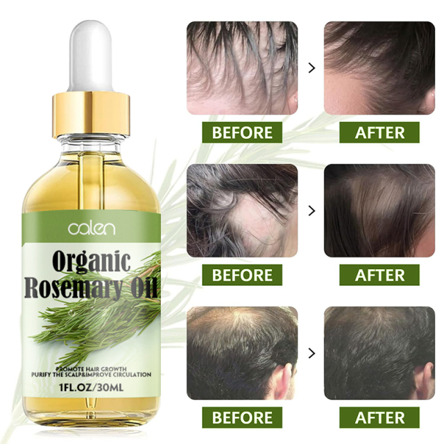 Luxfume Private Label Relieve Scalp Hair Regrowth Rosemary Hair Oil,oalen cosmetics