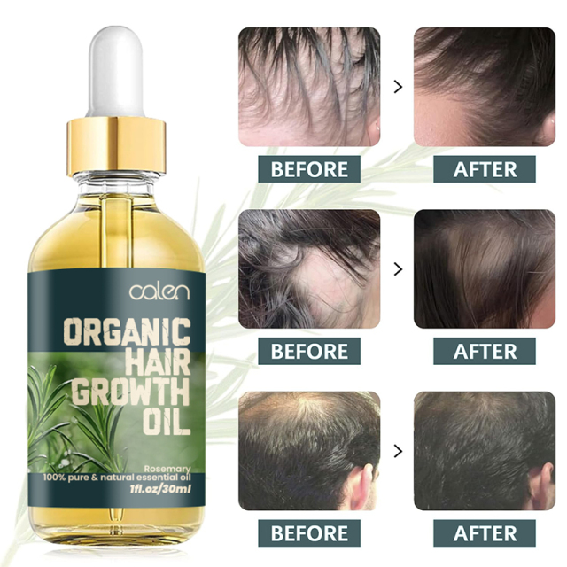 Luxfume 30ML Wholesale Private Label Promotes Hair Growth Antioxidant Oganic Rosemary Oil,oalen cosmetics