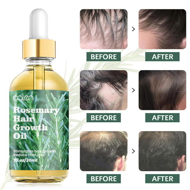 Luxfume Private Label Natural Ingredients Promote Hair Growth Baby Suitable Rosemary Growth Hair,oalen cosmetics