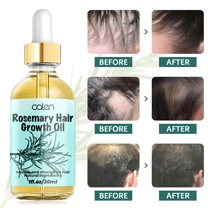 Luxfume 30ML Factory Improves Hair Texture Intensive Rosemary Oil Hair Growth,oalen cosmetics