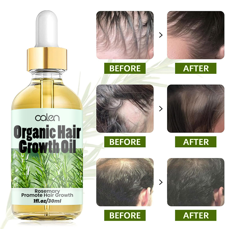 Oalen 30ML Factory ODM OEM Improves Hair Texture Intensive Deep Treatment Rosemary Oil,oalen cosmetics