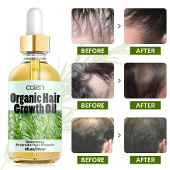Oalen 30ML Factory ODM OEM Improves Hair Texture Intensive Deep Treatment Rosemary Oil,oalen cosmetics