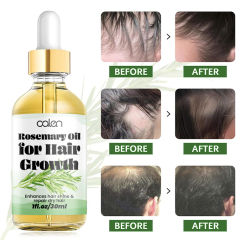 Oalen OEM Enhances Hair Dry Scalp Hair Growth Rosemary Oil,oalen cosmetics