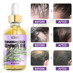 Luxfume High Quality Enhances Hair Elasticity Soothe Dry Scalp Hair Growth Rosemary Oil,oalen cosmetics