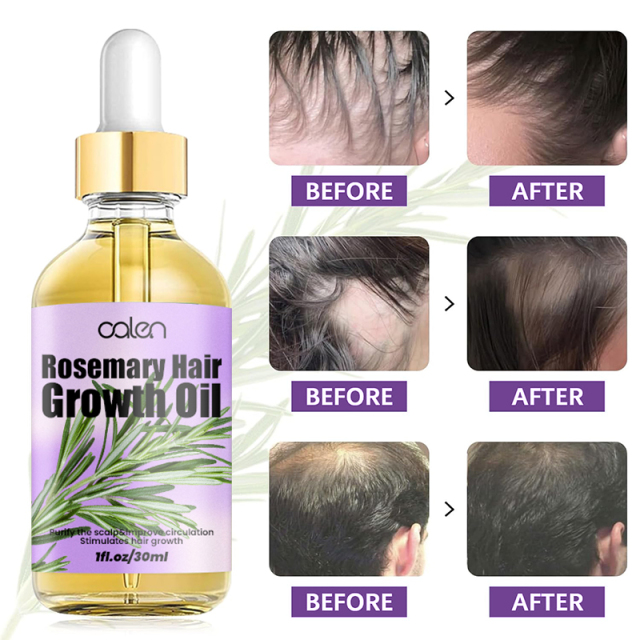 Luxfume High Quality Enhances Hair Elasticity Soothe Dry Scalp Hair Growth Rosemary Oil,oalen cosmetics