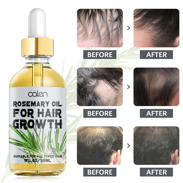 Oalen 30ML Wholesale Hair Growth Oganic Rosemary Oil,oalen cosmetics