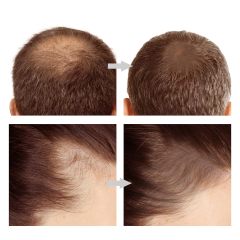 Luxfume Sweatproof Long Lasting Hair Loss Concealer Hairline Powder Stick,MY SHOP