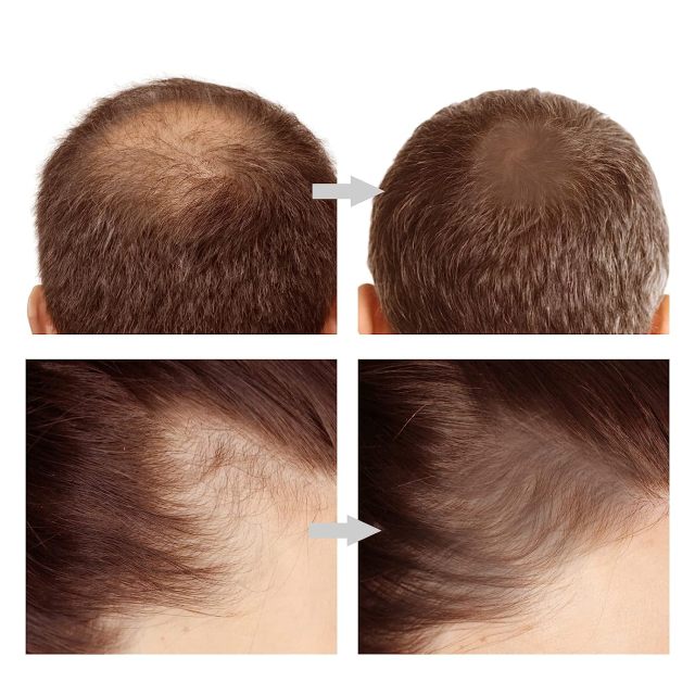 Luxfume Sweatproof Long Lasting Hair Loss Concealer Hairline Powder Stick,MY SHOP