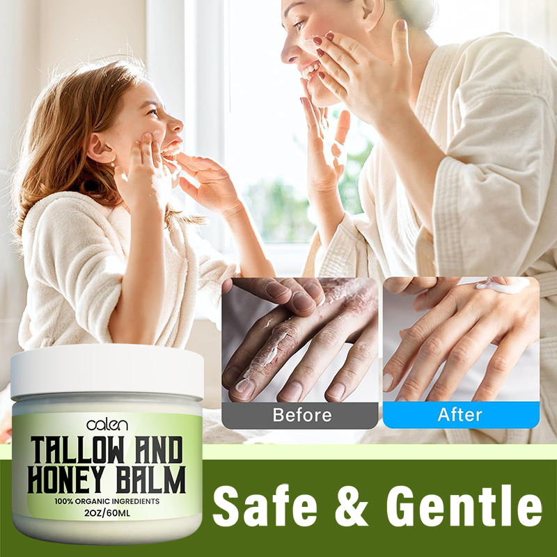 Oalen OEM ODM Private Label 60ML Face Cream Natural Beef Tallow Balm,oalen cosmetics