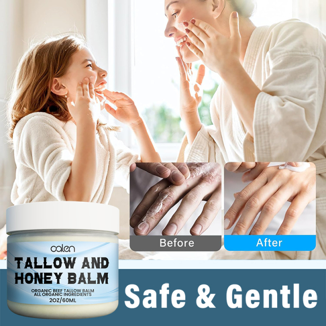 Oalen Private Label 60ml Whipped Skincare Grass Fed Beef All Purpose Tallow Balm,oalen cosmetics