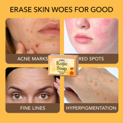 Oalen Private Label Skin Whitening Nature Honey Face Soap Handmade Soap For Acne,oalen cosmetics