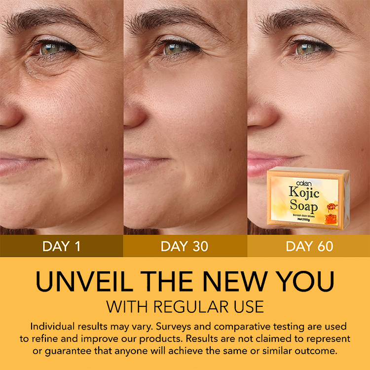 Oalen Private Label Skin Whitening Nature Honey Face Soap Handmade Soap For Acne,oalen cosmetics