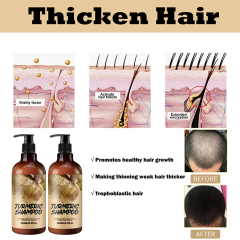 250ml Oalen OEM Promote Hair Growth Herbal Turmeric Ginger Shampoo,oalen cosmetics