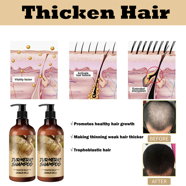 250ml Oalen OEM Promote Hair Growth Herbal Turmeric Ginger Shampoo,oalen cosmetics