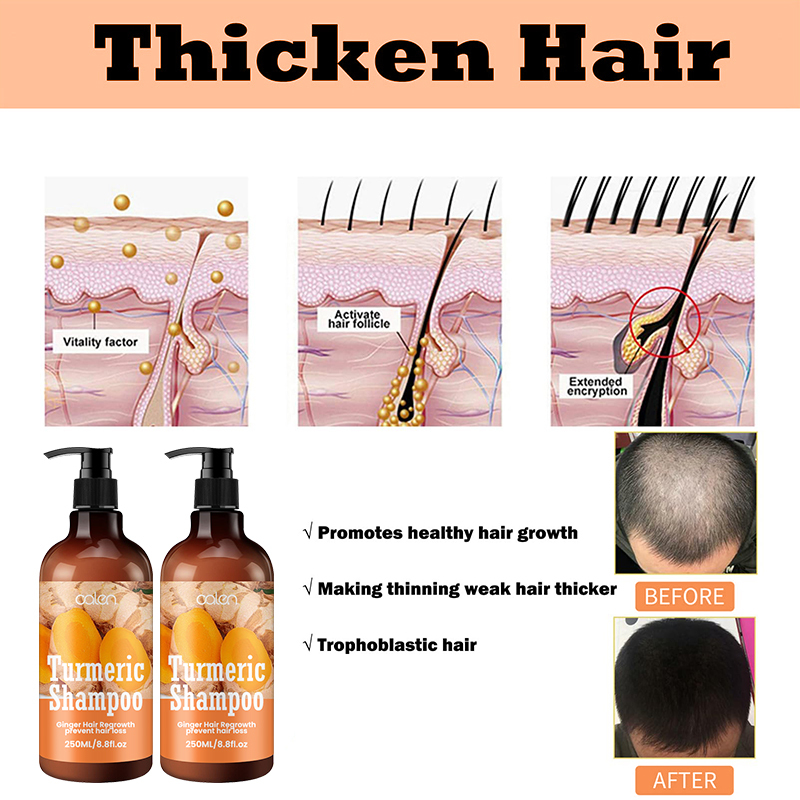 Oalen 250ML Private Label Nourishing Hair Turmeric Infused Shampoo,MY SHOP