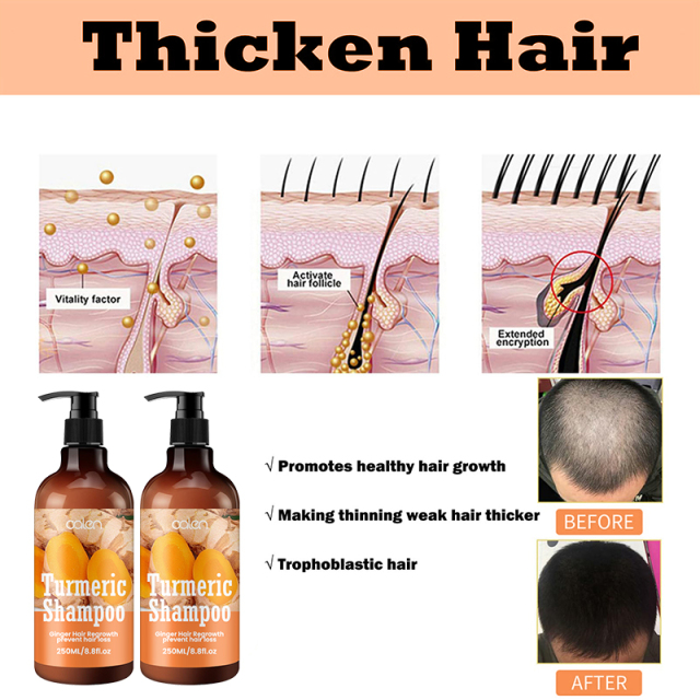 Oalen 250ML Private Label Nourishing Hair Turmeric Infused Shampoo,MY SHOP