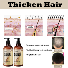 Oalen 250ML Hair Strengthening Scalp Nourishing Turmeric Shampoo,MY SHOP