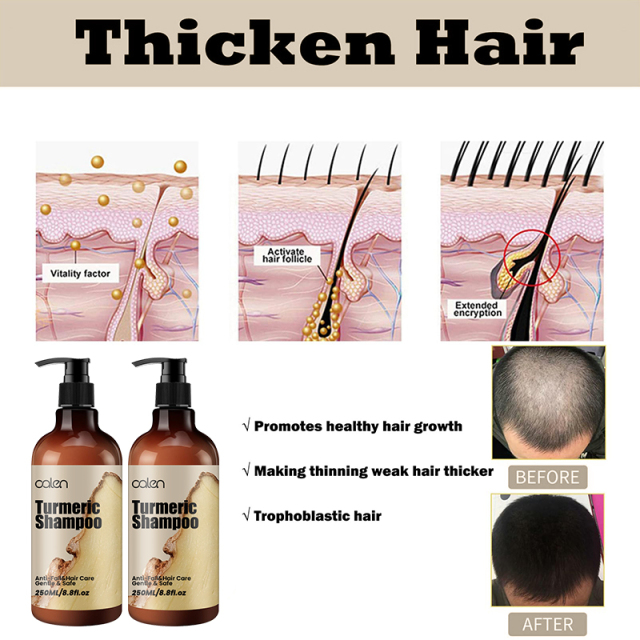 Oalen 250ML Hair Strengthening Scalp Nourishing Turmeric Shampoo,MY SHOP