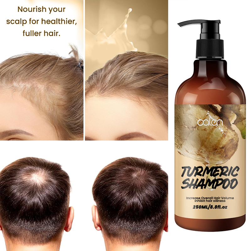 250ml Oalen OEM Promote Hair Growth Herbal Turmeric Ginger Shampoo,oalen cosmetics