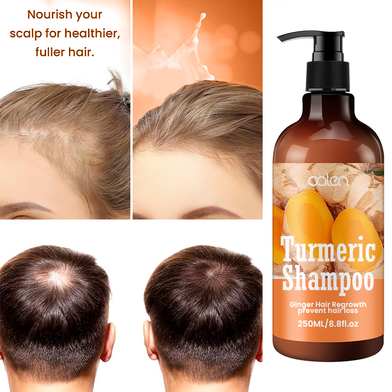 Oalen 250ML Private Label Nourishing Hair Turmeric Infused Shampoo,MY SHOP