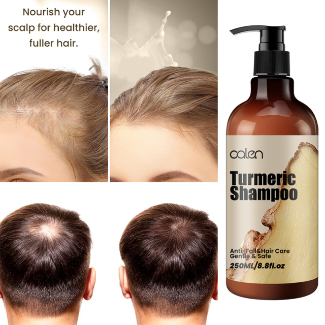 Oalen 250ML Hair Strengthening Scalp Nourishing Turmeric Shampoo,MY SHOP