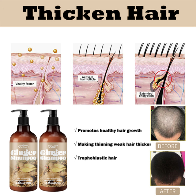 Luxfume Promotes Ginger Plant Extract Anti Hair Loss Shampoo 250ml,MY SHOP