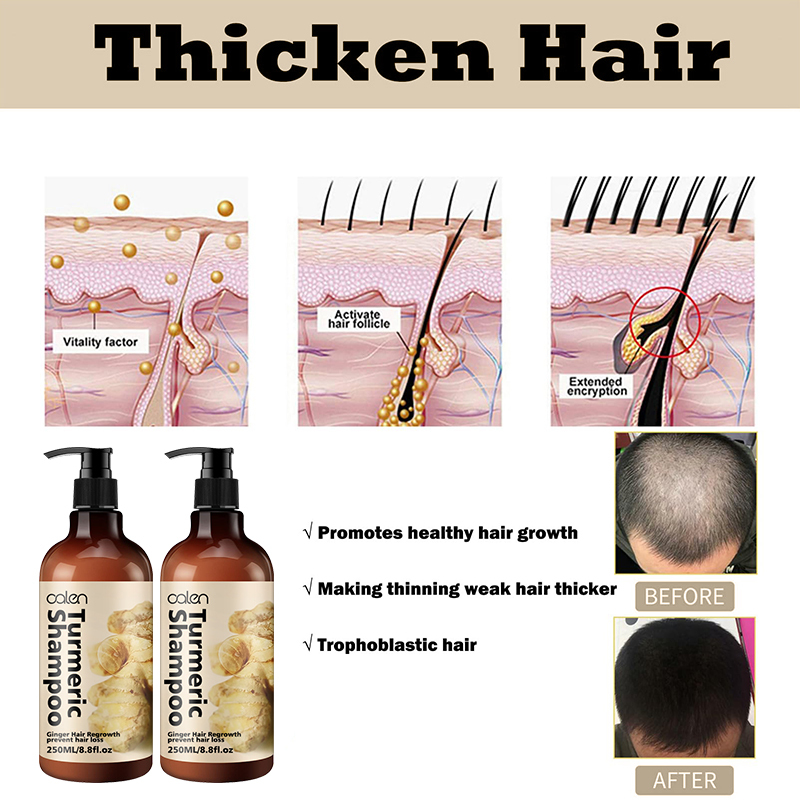 OALEN 250ml Turmeric Anti Strengthening Repairing Ginger Hair Shampoo,oalen cosmetics