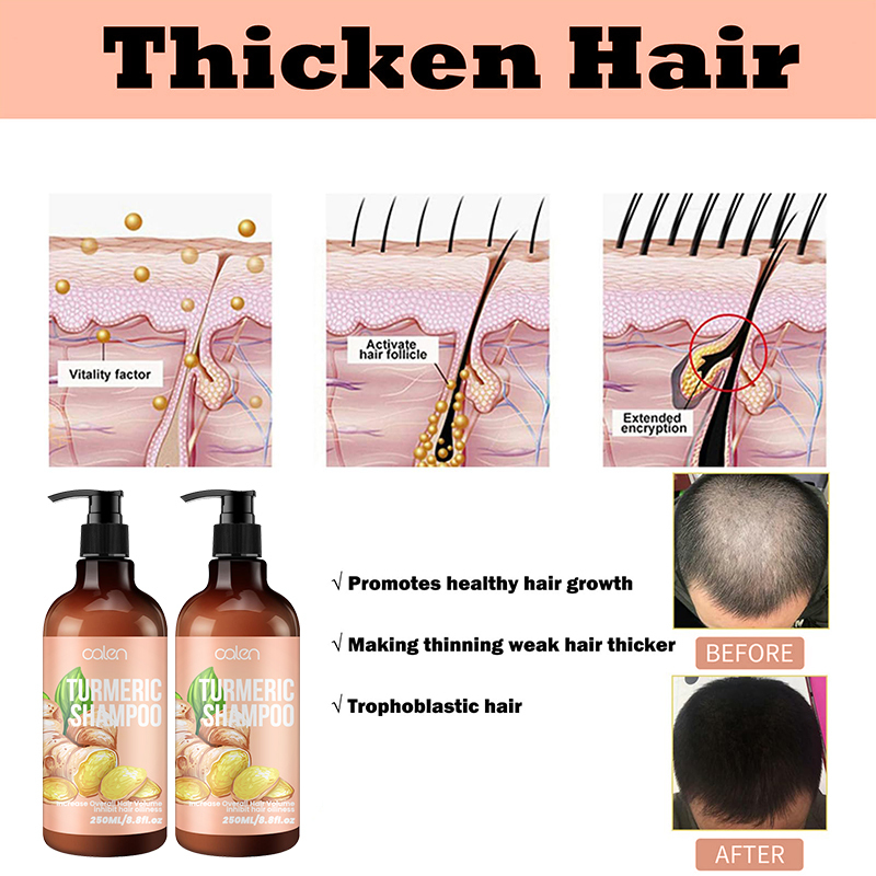250ML Luxfume OEM Increase Volume Repairs Damaged Hair Ginger Shampoo,MY SHOP