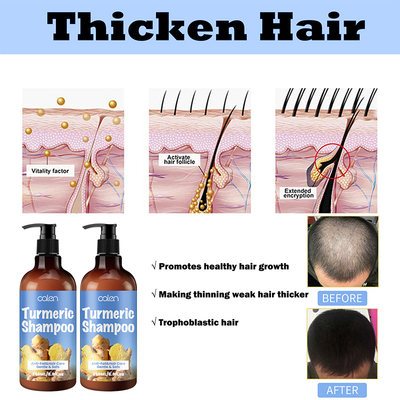Oalen Protective Scalp Nourishing Turmeric Hair Cleansing Shampoo,MY SHOP