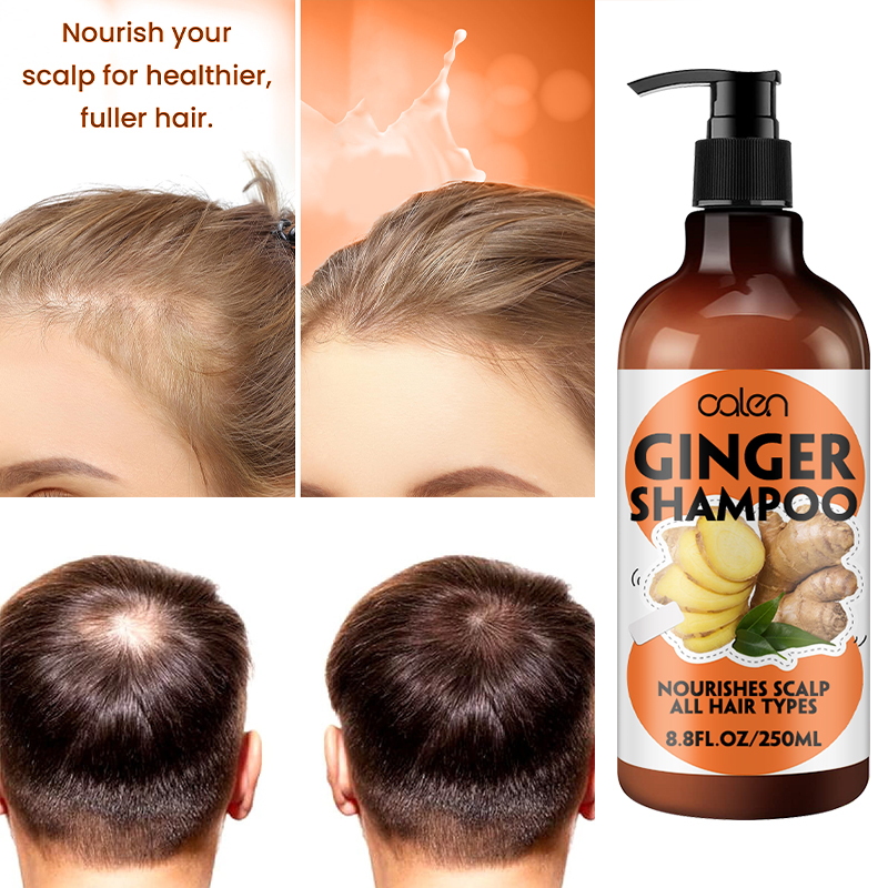 Oalen 250ml Nutrient Rich Scalp Radiant Ginger Hair Growth Shampoo,MY SHOP