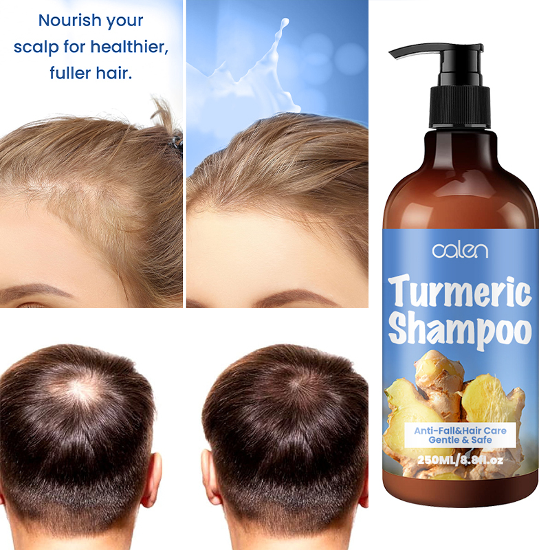 Oalen Protective Scalp Nourishing Turmeric Hair Cleansing Shampoo,MY SHOP