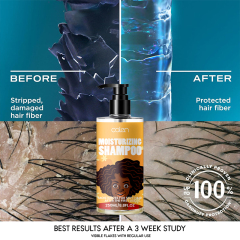 Oalen Private Label 250Ml Clean Dandruff Strong Healthy Hair Shampoo,MY SHOP