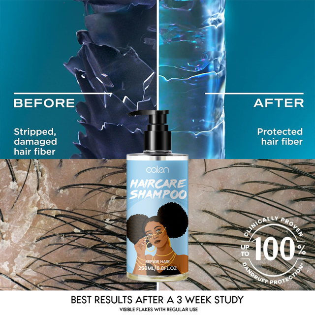 Oalen Custom Logo 250Ml Deep Cleans Refreshes Scalp Best Dry Shampoo,MY SHOP
