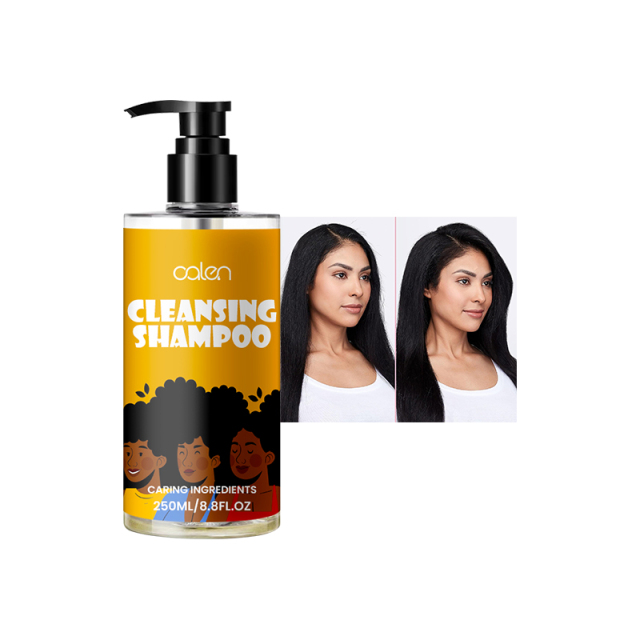 Oalen OEM Hydrate Moisturizing Good Shampoo For Dandruff Removal,MY SHOP