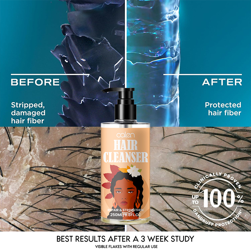 Oalen 250Ml Smooth Shiny Hair Moisturizing Shampoo Best Shampoo,MY SHOP