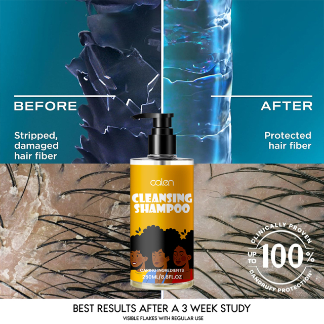 Oalen OEM Hydrate Moisturizing Good Shampoo For Dandruff Removal,MY SHOP