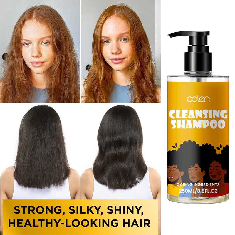 Oalen OEM Hydrate Moisturizing Good Shampoo For Dandruff Removal,MY SHOP