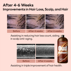 Oalen Private Label 250Ml Natural No Itching Irritation Oud Shampoo,MY SHOP