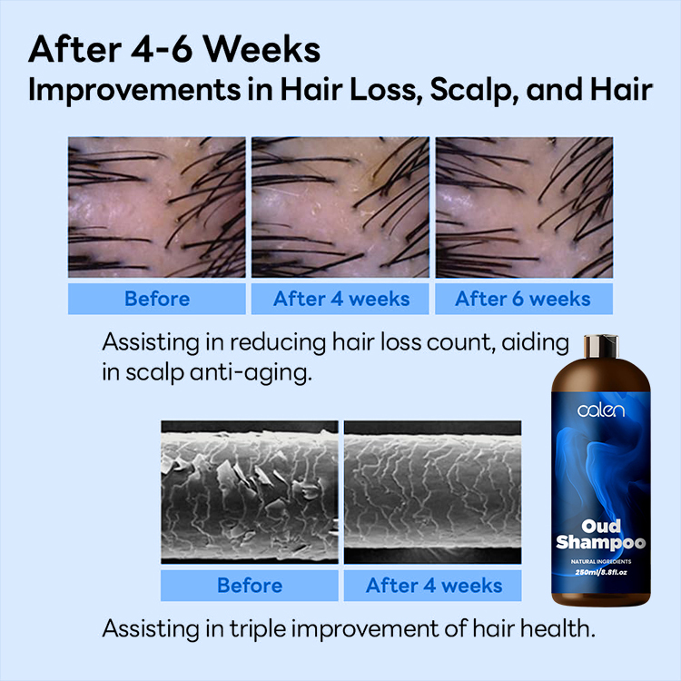 Oalen OEM Cleanse Strengthening Soothing Formula Oud Hair Shampoo,MY SHOP
