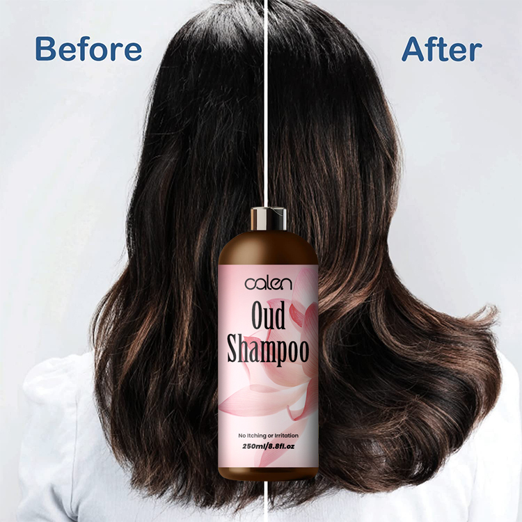 Oalen 250Ml Prevents Dandruff Nourishes Repairs Damaged Oud Shampoo,MY SHOP